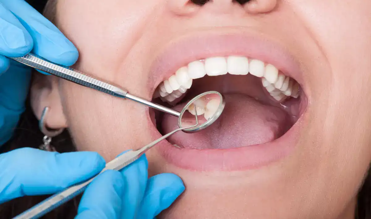 Free Governments Grant For A Dental Implant 2021