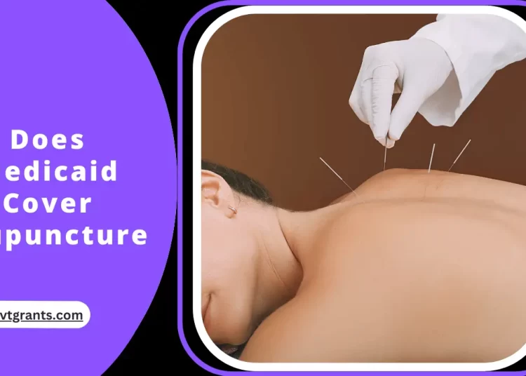 Does Medicaid Cover Acupuncture